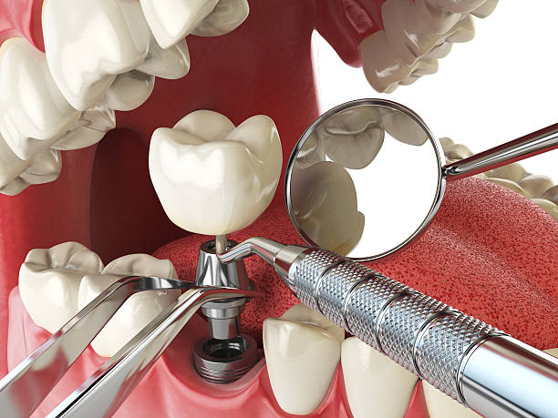 Best Emergency Dental Extractions in Colony Rk, PA